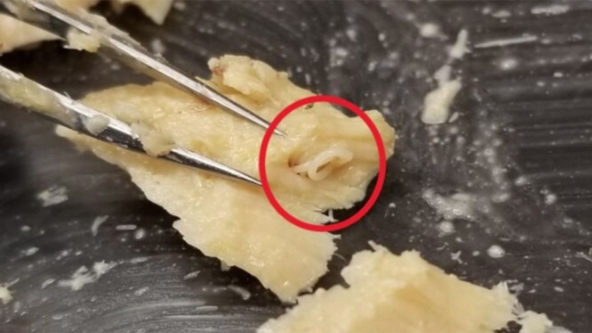tweezers pulling ringworm from piece of fish